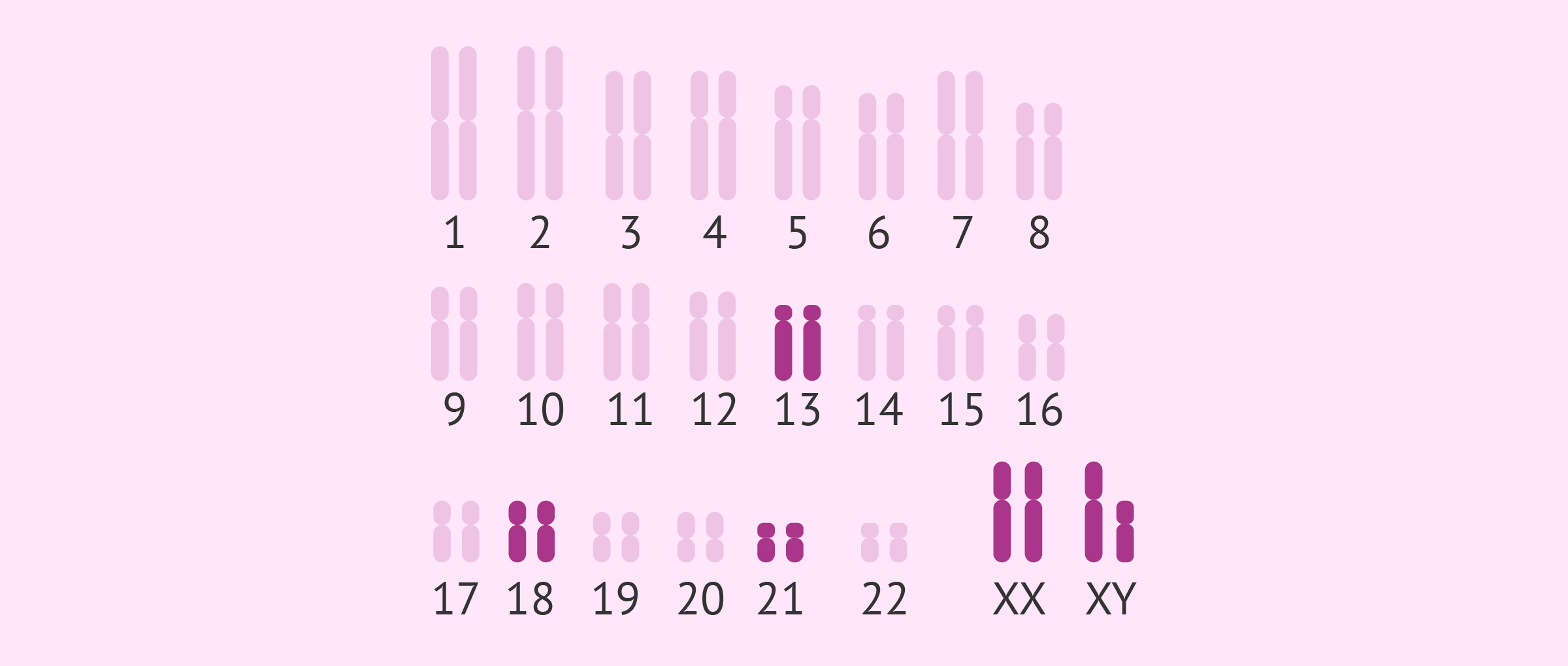 Anàlisi de cromosomes del fetus