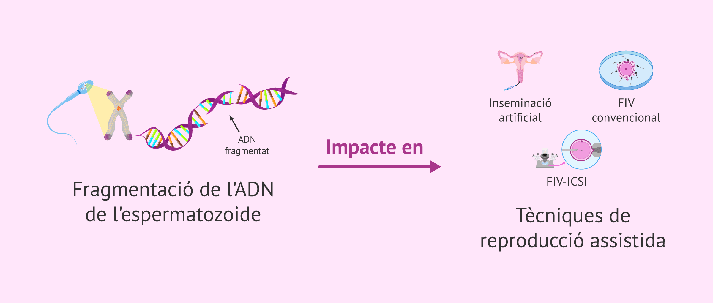 ADN espermàtic danyat: impacte en FIV, ICSI i inseminació