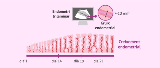 Imagen: Creixement i característiques de l'endometri per a la implantació