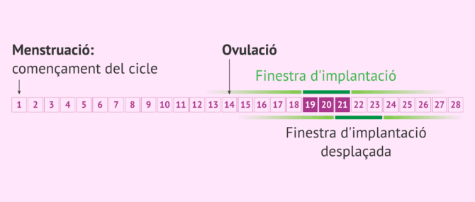 Imagen: Finestra d'implantació i test ERA