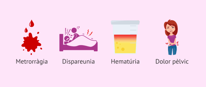 Imagen: Alguns possibles signes d'endometriosi