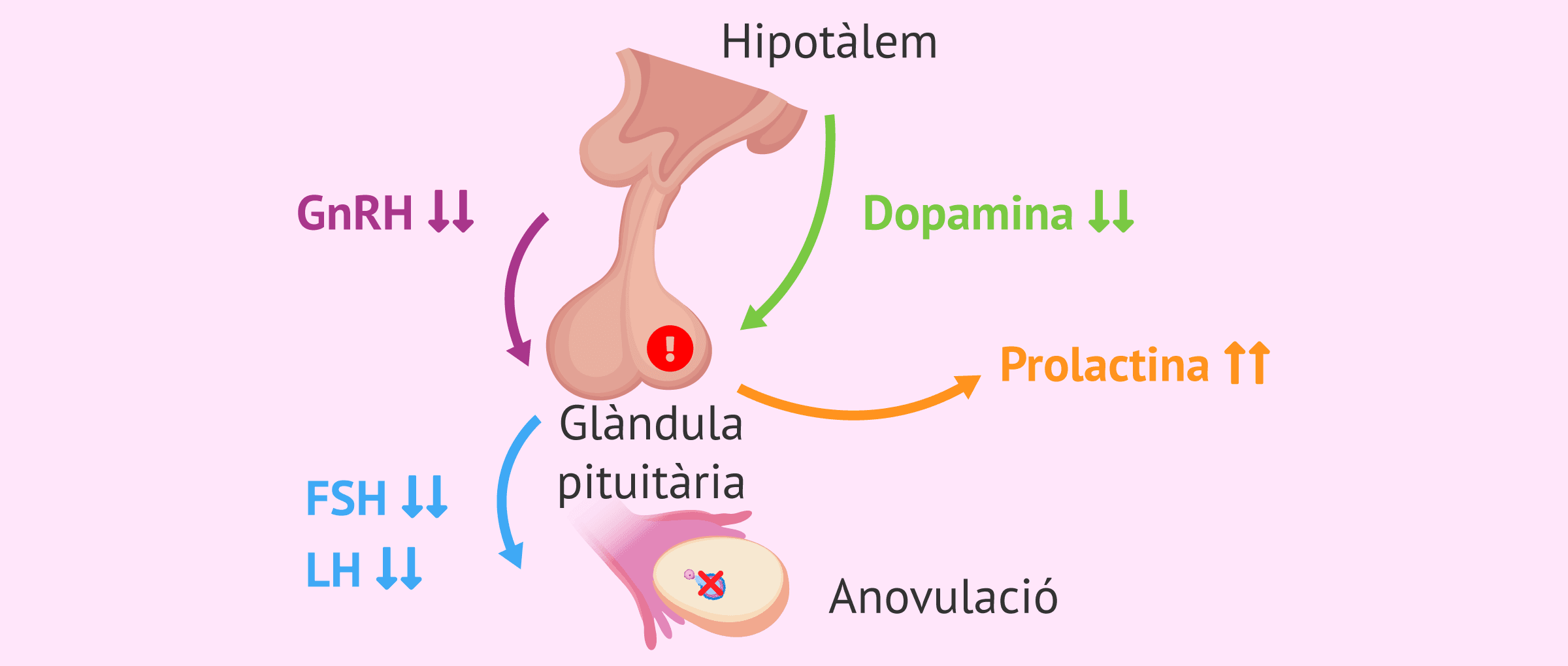 Malalties que causen infertilitat femenina: signes d'alerta