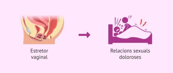 Imagen: Conseqüència del vaginisme en la dona