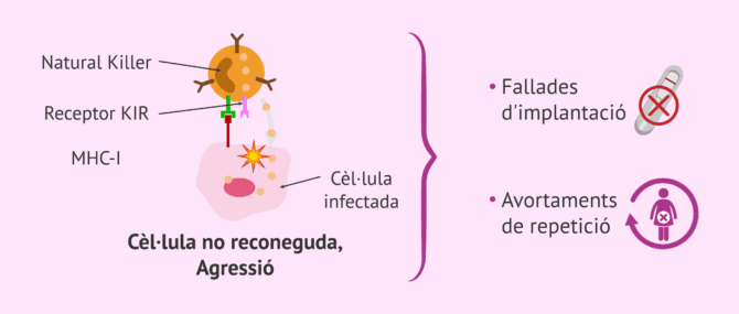 Imagen: Infertilitat alloimmune per cèl·lules NK elevades
