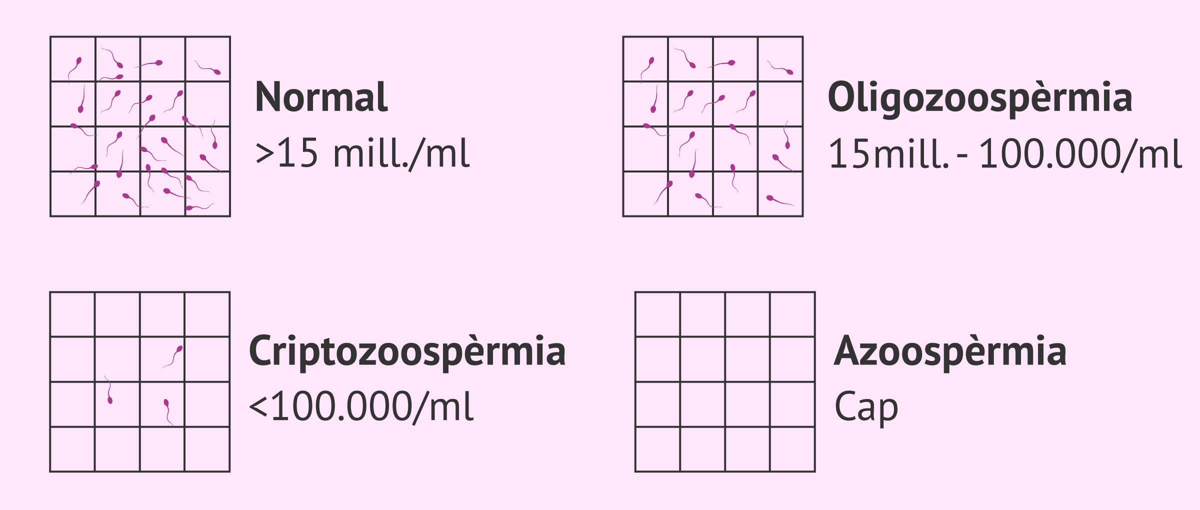 Esterilitat masculina per factor espermàtic: causes i tractaments