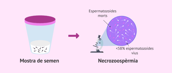 Imagen: Esterilitat masculina per necrozoospèrmia