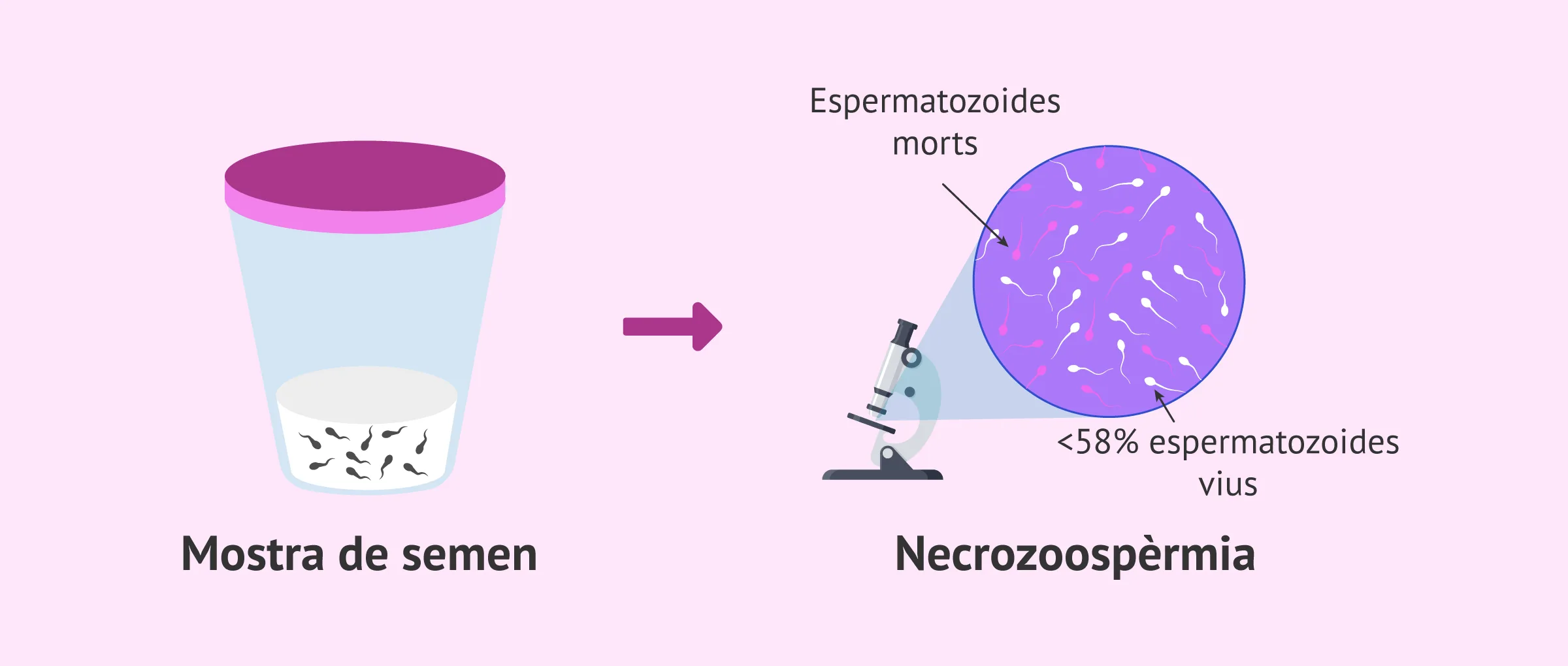 Esterilitat masculina per necrozoospèrmia