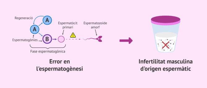 Imagen: Un error en l'espermatogènesi causa infertilitat masculina