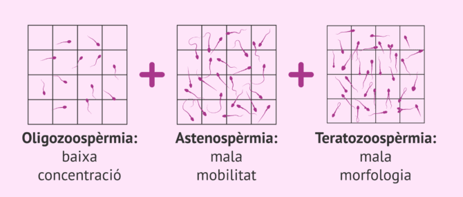 Imagen: Definició d'oligoastenoteratozoospèrmia