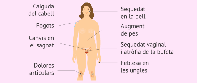 Imagen: Símptomes en el climateri i la menopausa