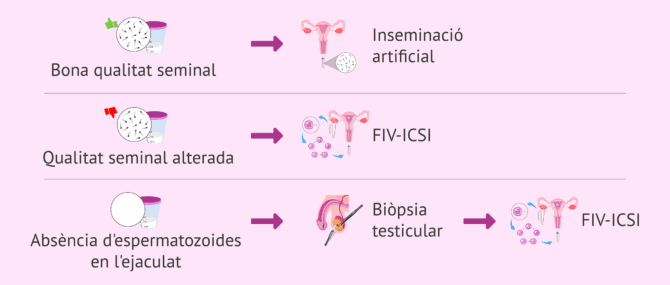 Imagen: Tractaments de fertilitat en homes amb problemes espermàtics