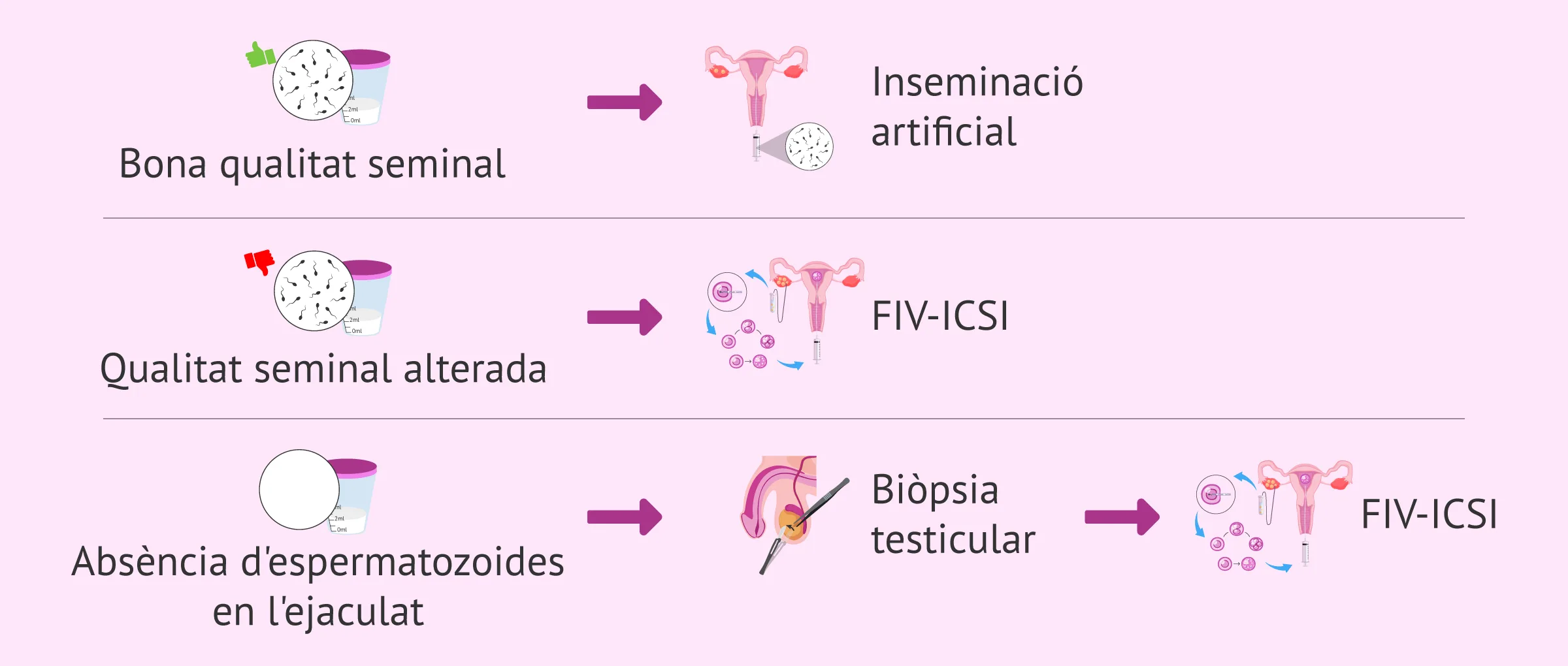 Tractaments de fertilitat en homes amb problemes espermàtics