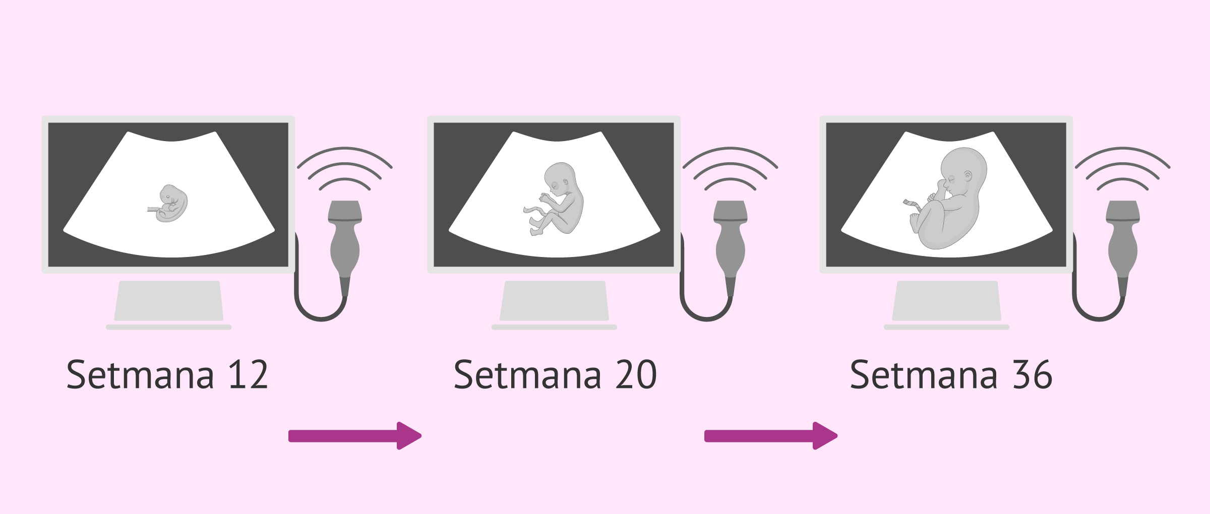 Ecografies del fetus durant l'embaràs
