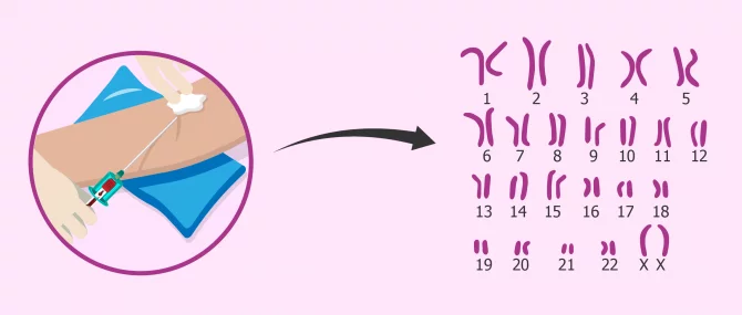 Imagen: Cariotip per a diagnosticar esterilitat d’origen cromosòmic