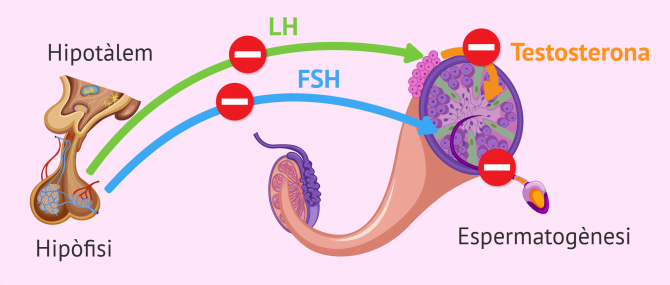 Imagen: Factor endocrí d’esterilitat masculina