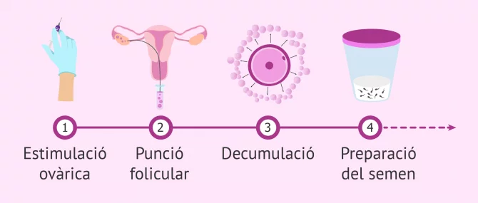Imagen: Etapes del procés de la ICSI