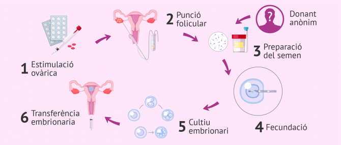Imagen: Fecundació in vitro per a dona soltera