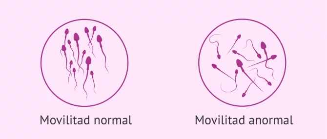 Imagen: ICSI per problemes de mobilitat dels espermatozoides