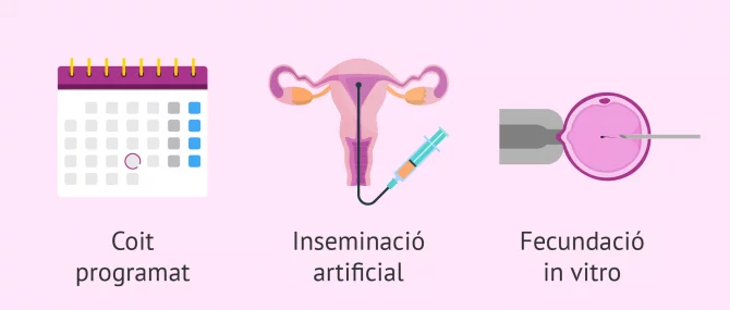 Imagen: Tractament de la infertilitat femenina