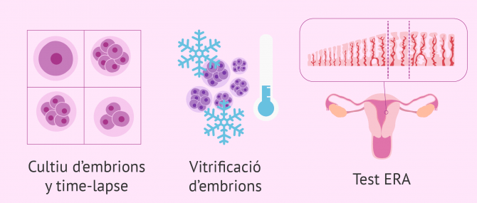 Imagen: Avanços en reproducció assistida