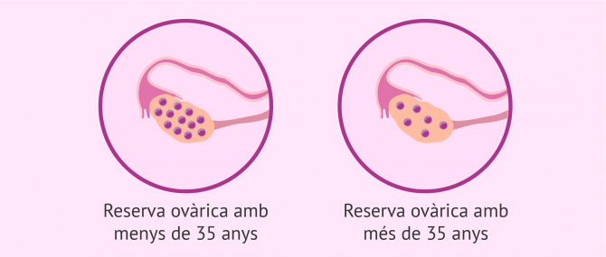 Imagen: Reserva ovàrica y edat de la dona