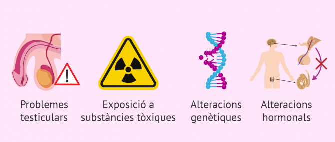 Imagen: Causes de la azoospèrmia secretora