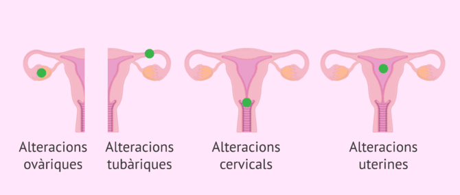 Imagen: Per què es produeix la infertilitat femenina?