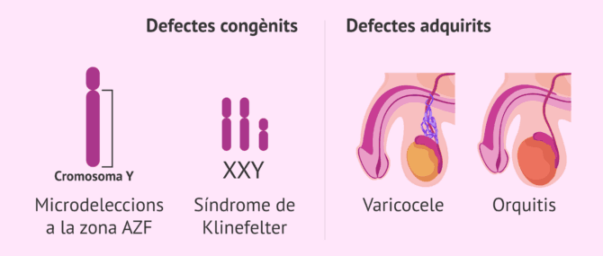 Imagen: Causes testiculars d'infertilitat en l'home