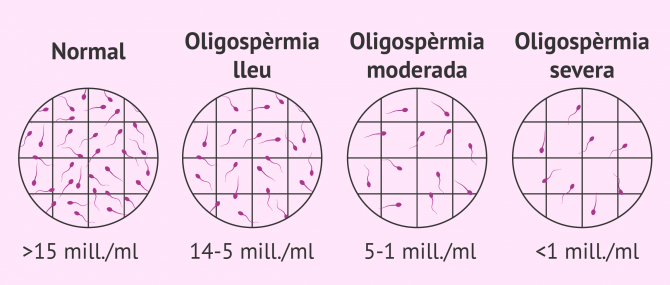 Imagen: Graus de oligospermia en mostres de semen