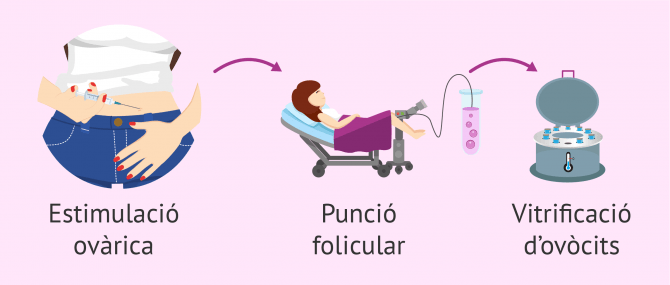 Imagen: Passos per a congelar òvuls
