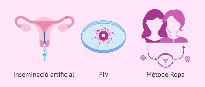 Imagen: Tècniques de reproducció assistida per a ser mares lesbianes