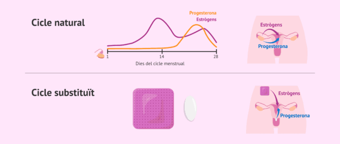Imagen: Tipus de preparació endometrial per a transferir embrions congelats