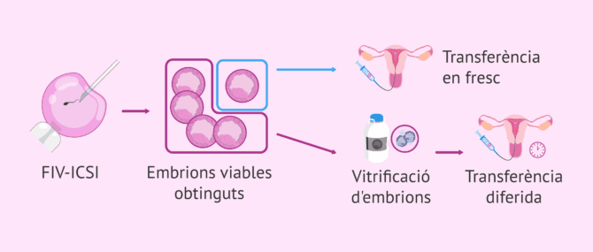 Imagen: Resultats perinatals després de transferir en fresc o en diferit