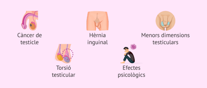 Imagen: Complicacions de la criptorquídia
