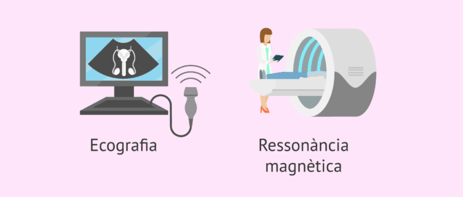Imagen: Diagnòstic de la criptorquídia mitjançant ecografia i ressonància magnètica