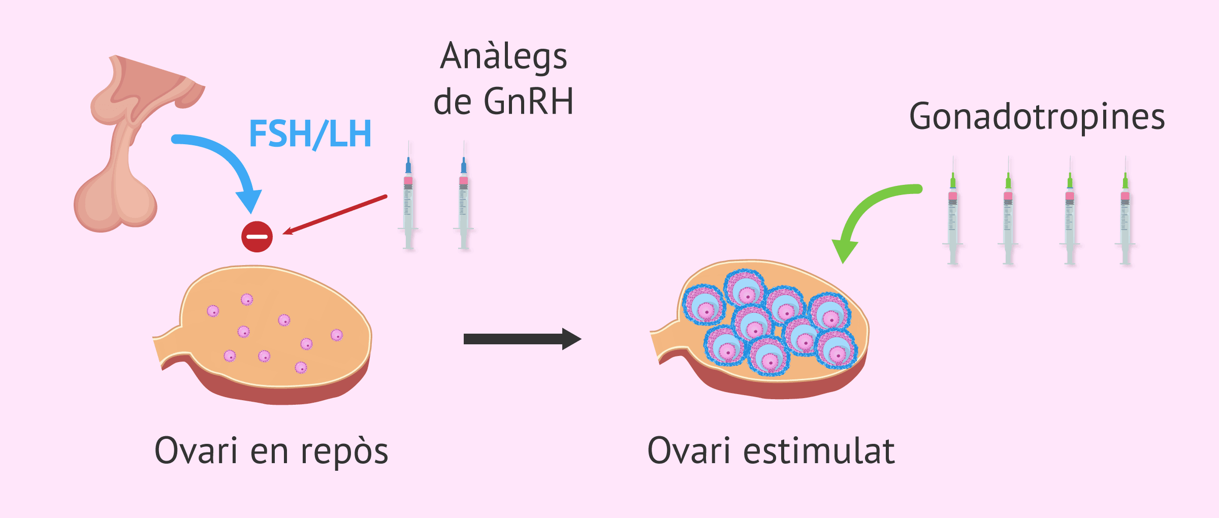Què és l'estimulació ovàrica? - Procés, medicaments i símptomes