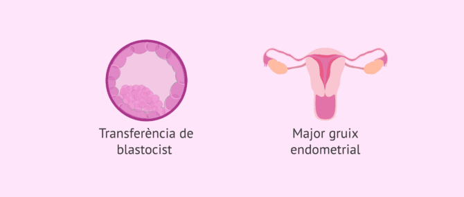 Imagen: Estratègies per a la fallada d'implantació