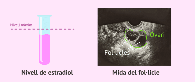 Imagen: Seguiment i controls de l'estimulació ovàrica