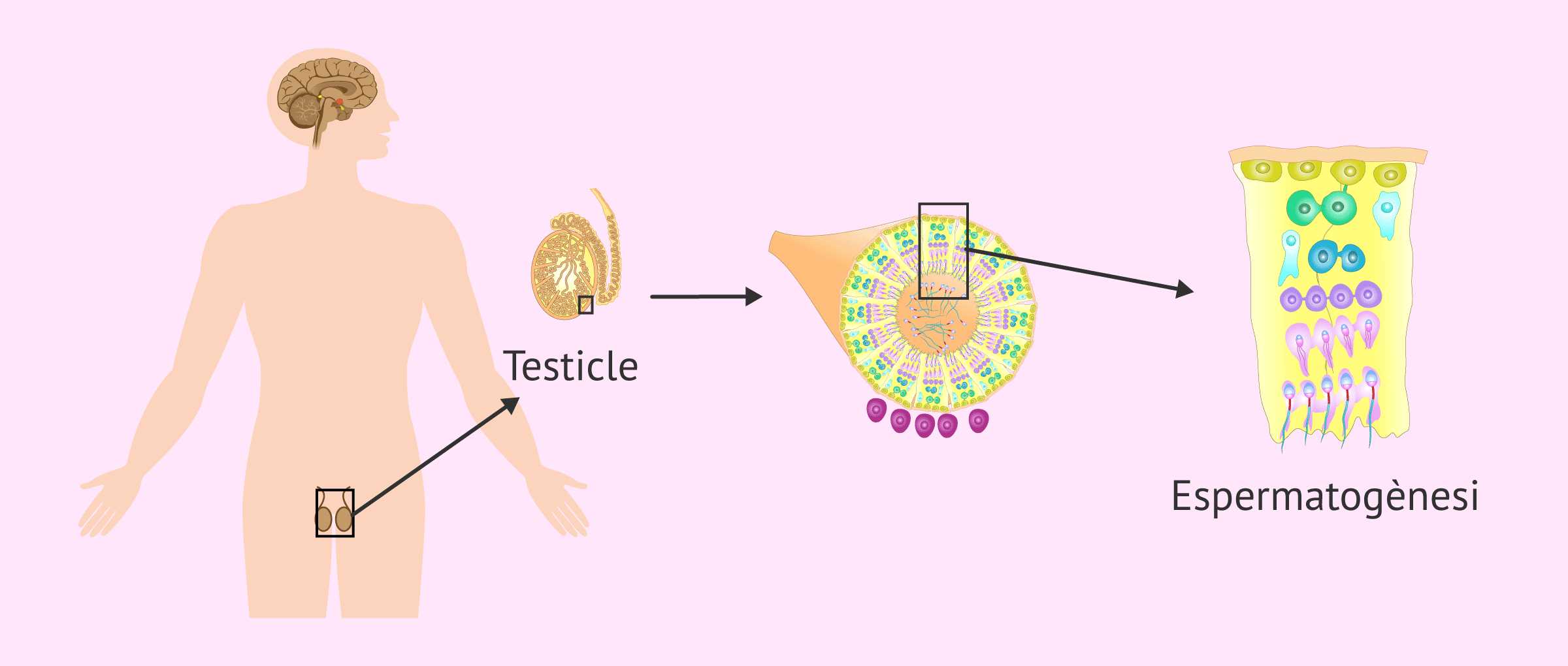 L'esterilitat masculina per un factor testicular congènit o adquirit