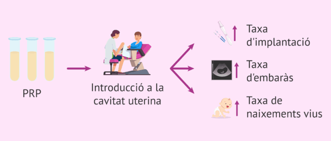 Imagen: És efectiu el plasma ric en plaquetes en reproducció assistida?