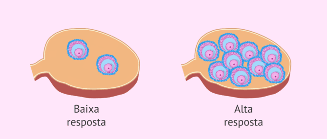Imagen: Tipus de resposta a l'estimulació ovàrica