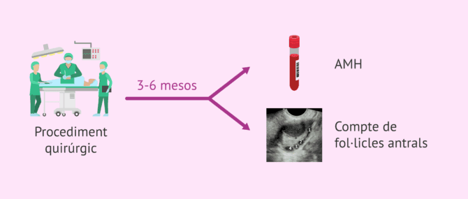 Imagen: Reserva ovàrica després d'operació per endometriosi