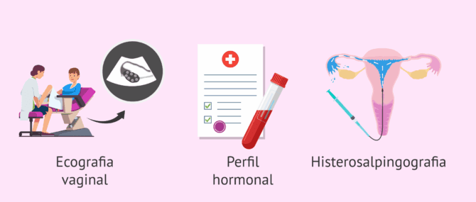 Imagen: Primeres proves de fertilitat en la dona