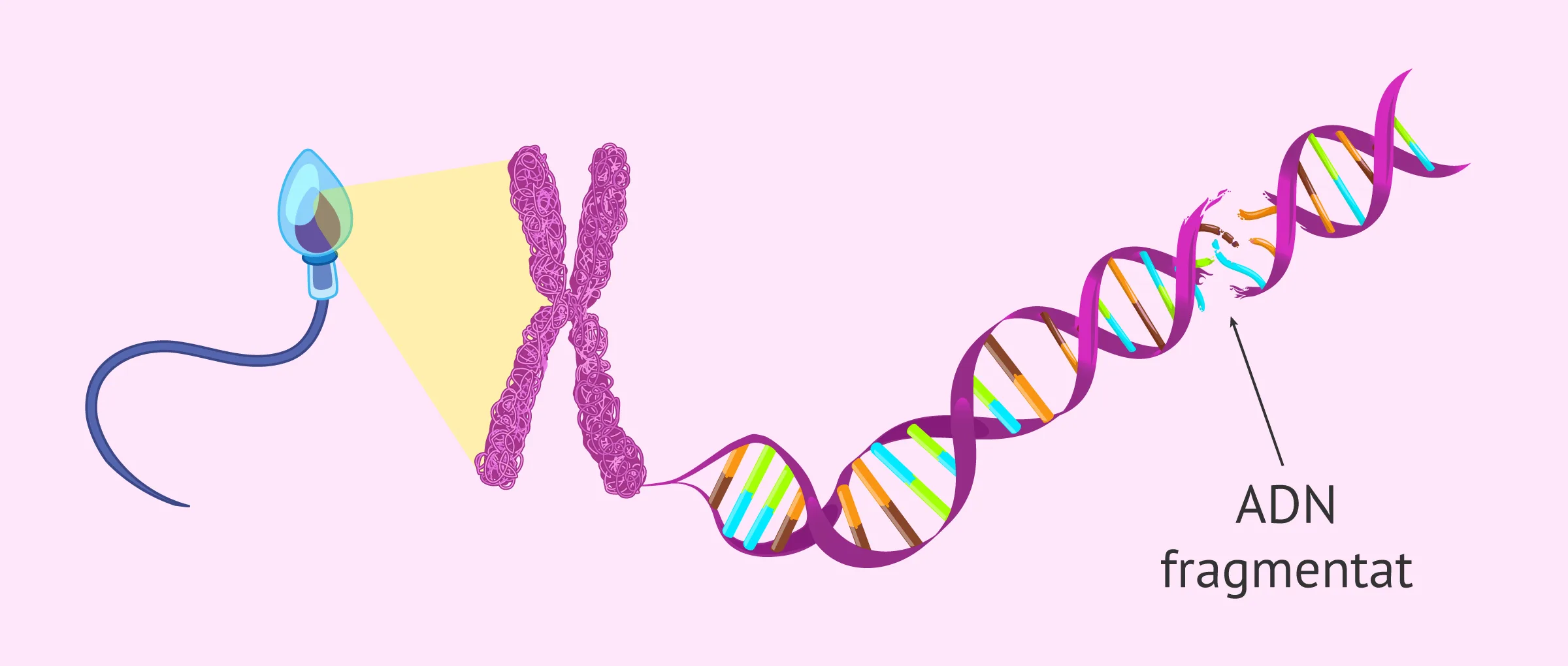 Fragmentació de l'ADN espermàtic i la seva implicació en la fertilitat