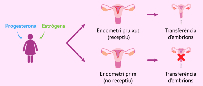 Imagen: Com ha d'estar l'endometri per a la transferència?