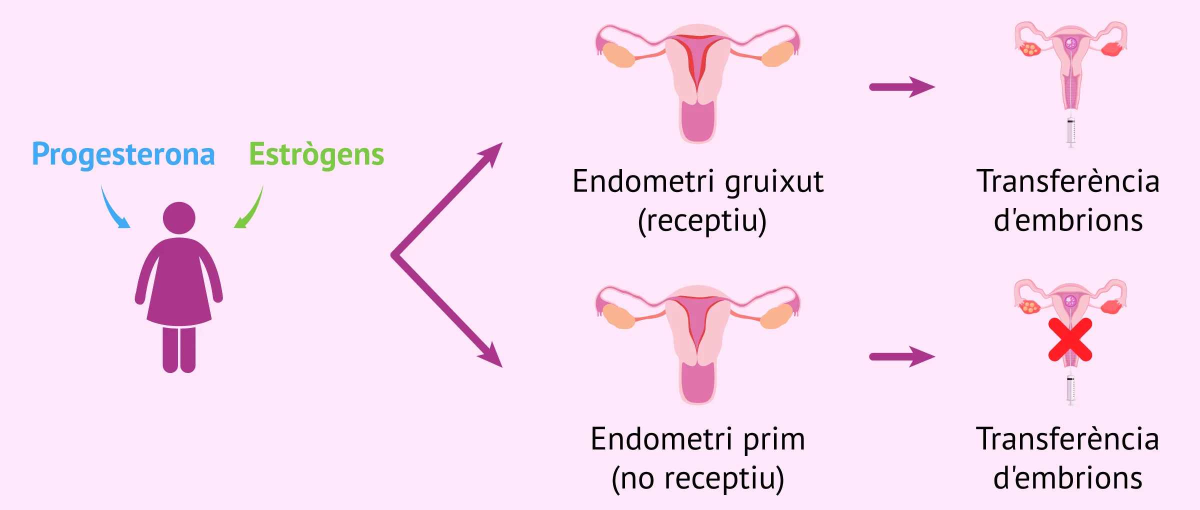 Com ha d'estar l'endometri per a la transferència?