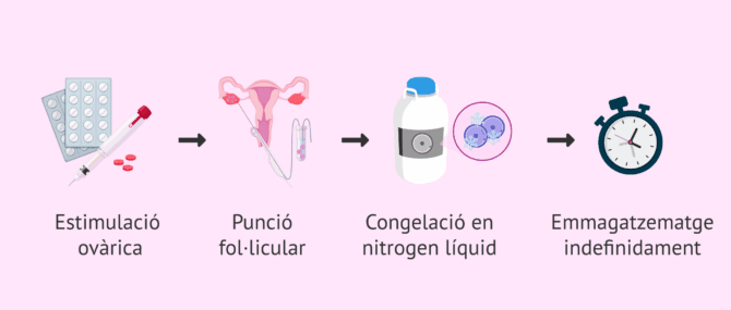 Imagen: Procés de la preservació de la fertilitat femenina