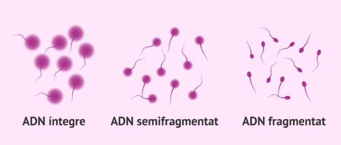 Imagen: Test de dispersió de la cromatina espermàtica