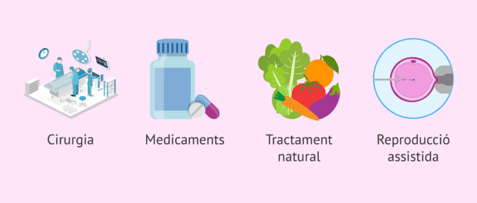 Imagen: Possibles tractaments de l'oligoastenoteratospèrmia