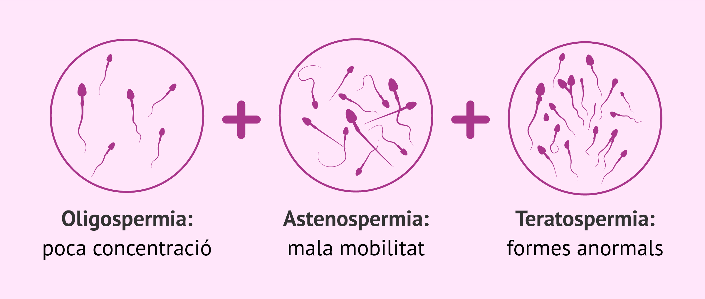 Oligoastenoteratospermia: tractament i com aconseguir l'embaràs